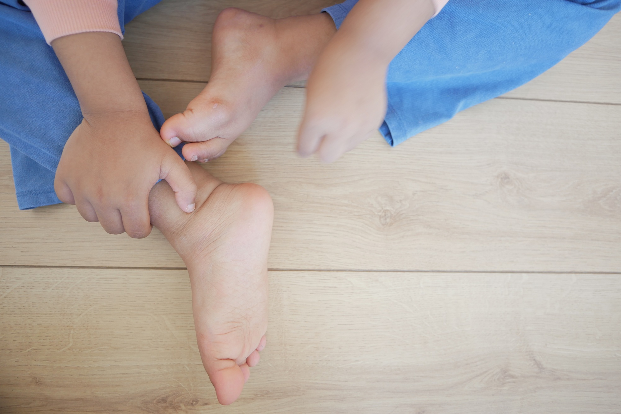 a kid suffering from itching skin on feet