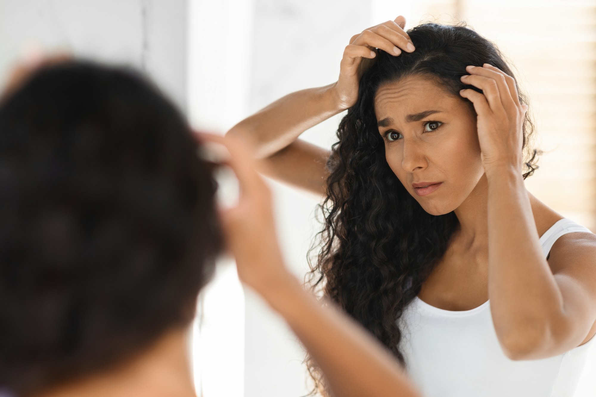 Dandruff Problem. Upset Young Female Looking At Hair Roots In Bathroom