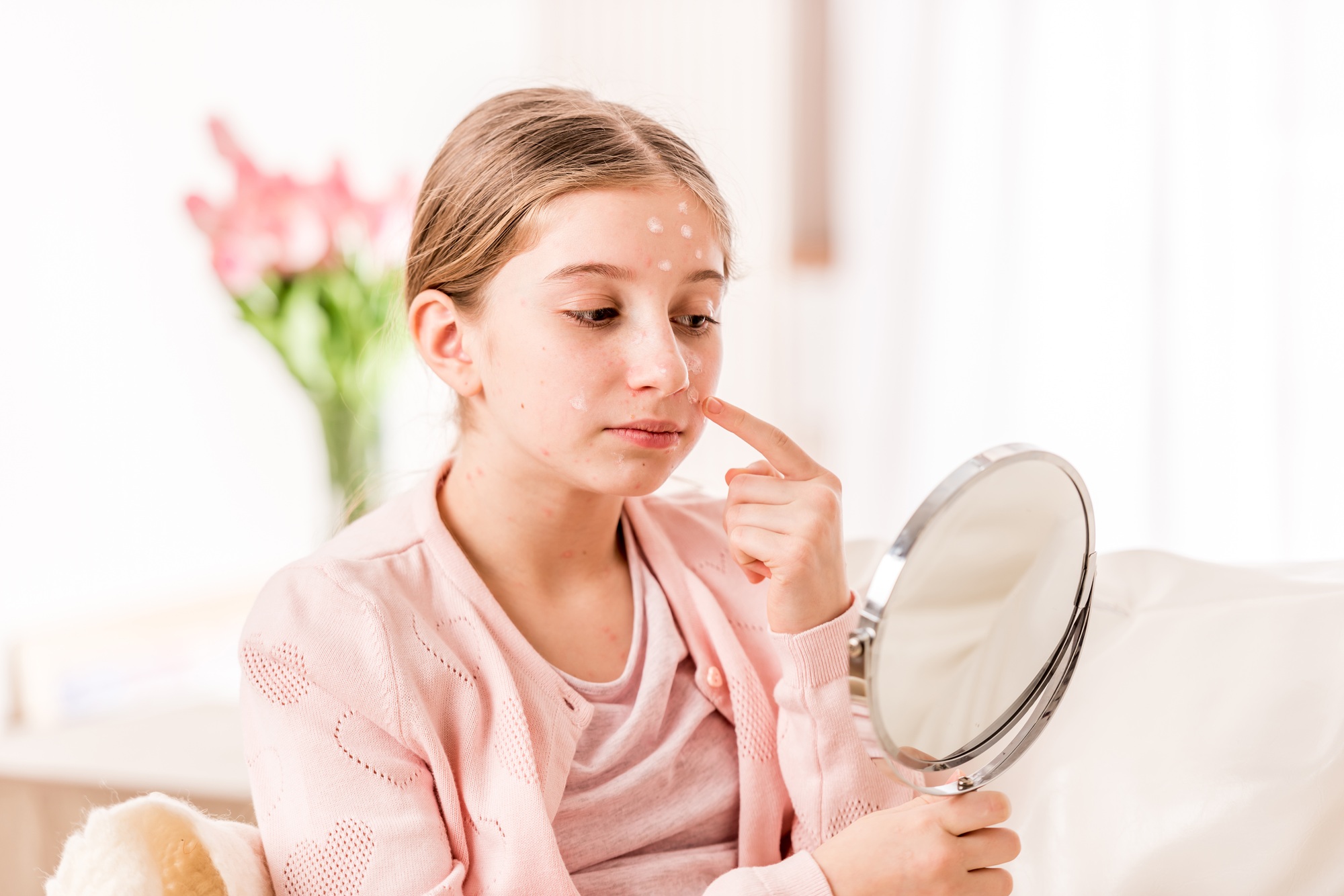 Girl with chickenpox looking at the mirror