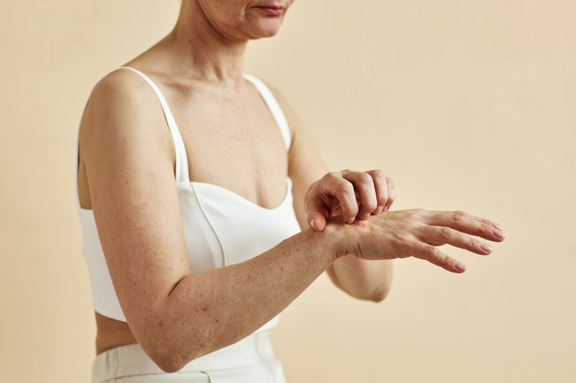 Minimal senior woman scratching hands skin condition