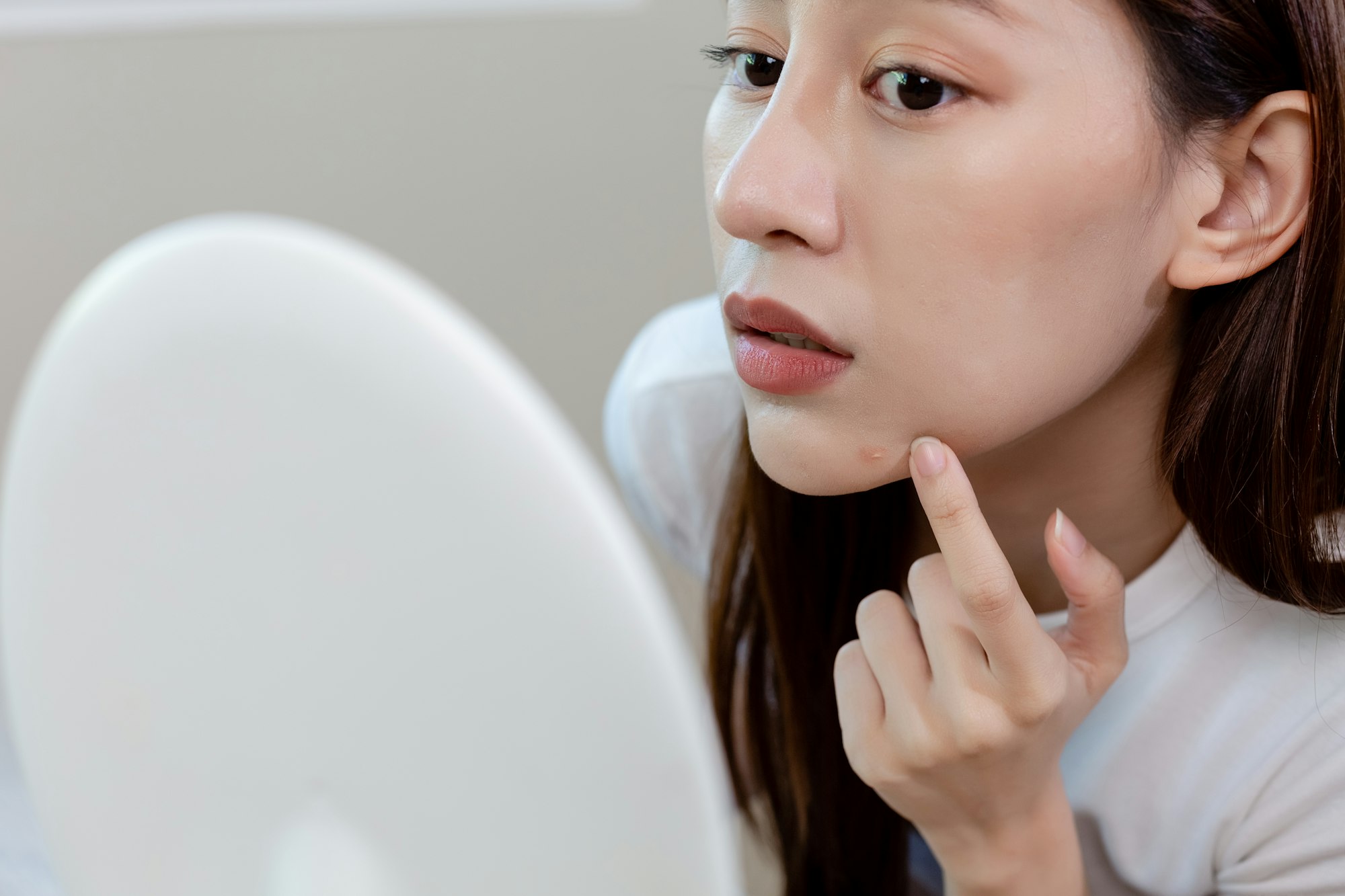 young woman squeezing acne with skin problems on face, treatment pimple of skin problems on face.