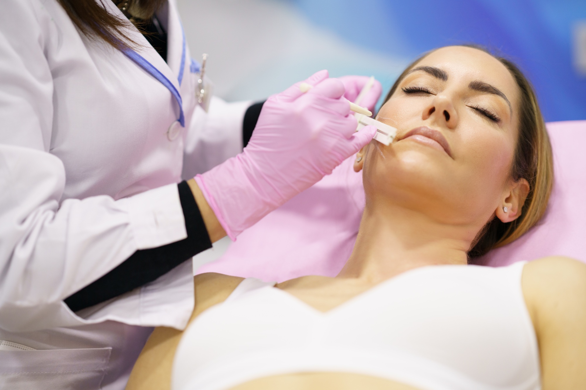 Doctor painting the area of a woman's face where the PDO suture treatment threads will be injected.