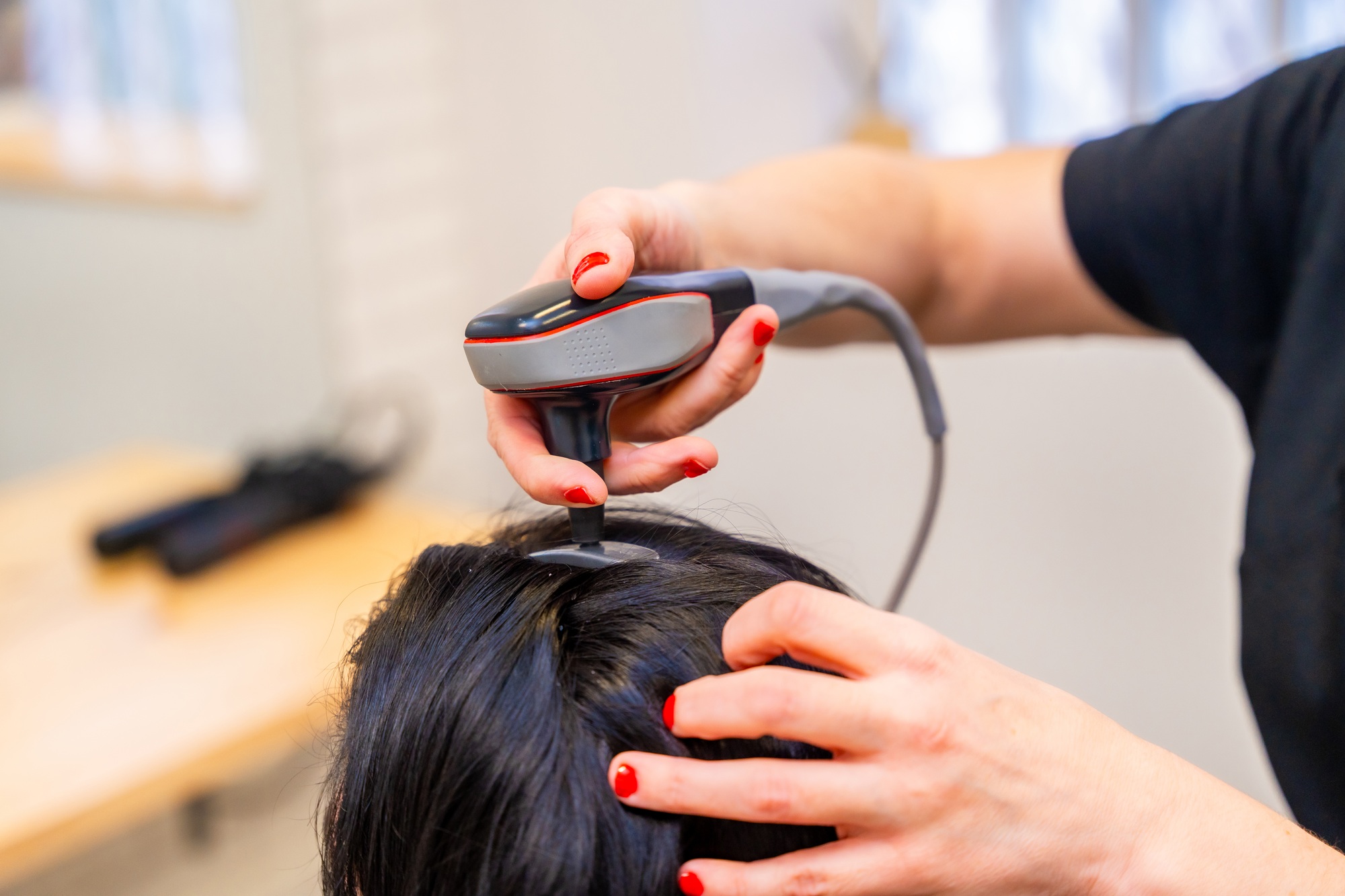 Woman receiving hair loss treatment at capillary clinic