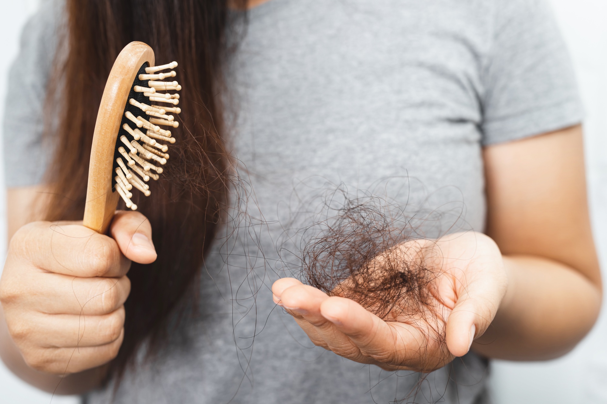 Women have hair loss problems