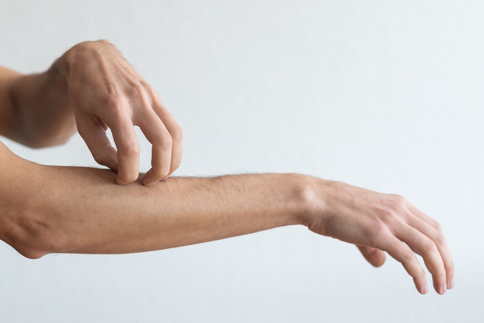 Dermatitis, eczema, allergy, psoriasis concept. man scratching itch on his arm, grey studio