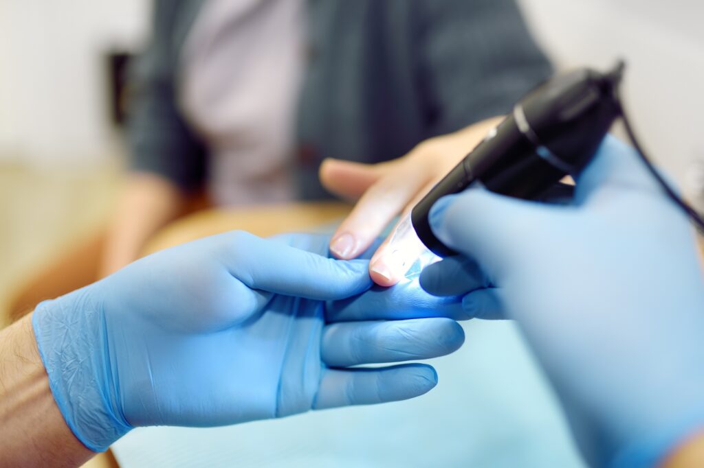 Doctor examines the nail bed and blood vessels of a young woman's fingers through a microscope