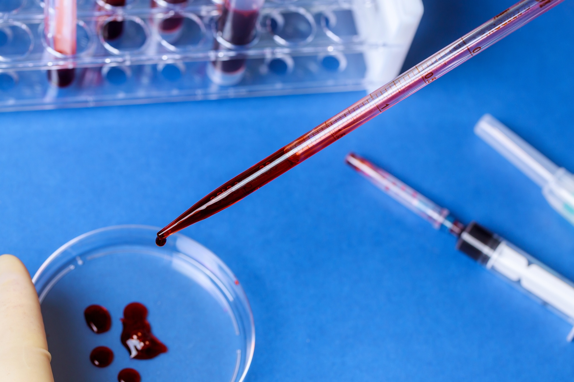 Pipette and petri dish with blood test tube in a medical analysis hospital laboratory