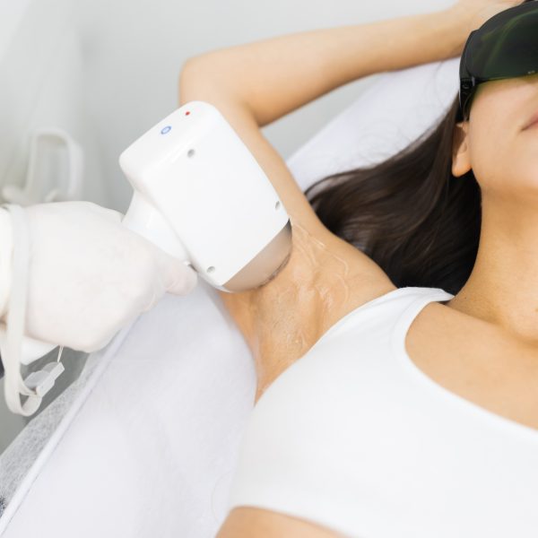 Armpit laser hair removal