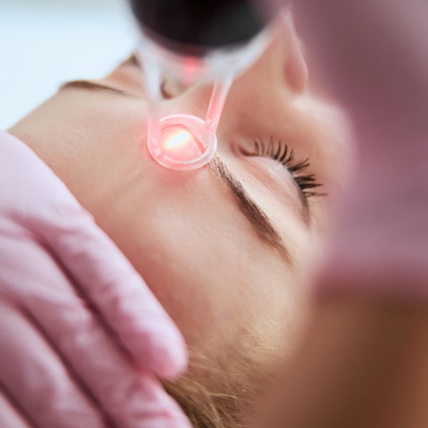 Caucasian female getting a laser skin treatment