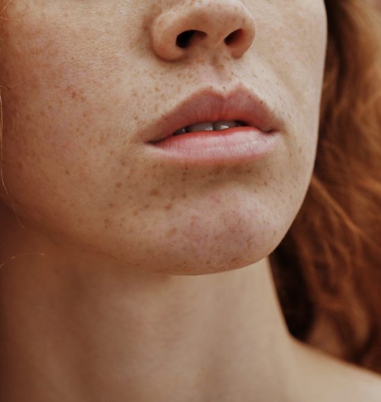 Young female face with freckles